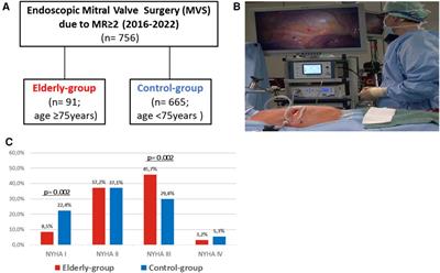 Early outcome of endoscopic mitral valve surgery in elderly patients: a high-volume single center experience